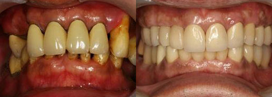 治療前VS.治療後。