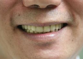 病患恢復自信笑容。