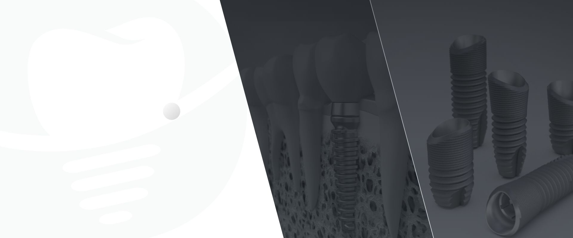 making your smile 豐富臨床經驗 植牙的專家